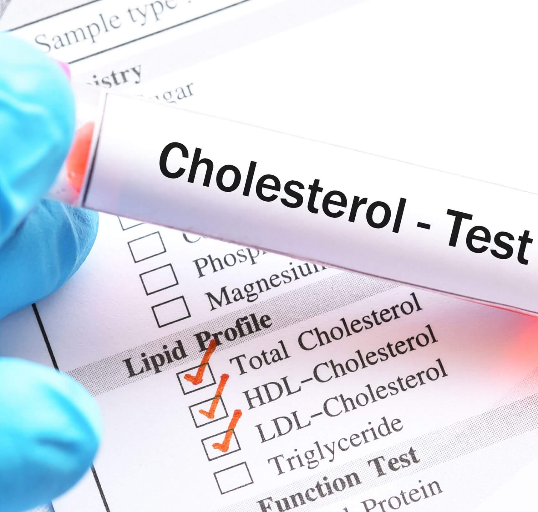 cholesterol